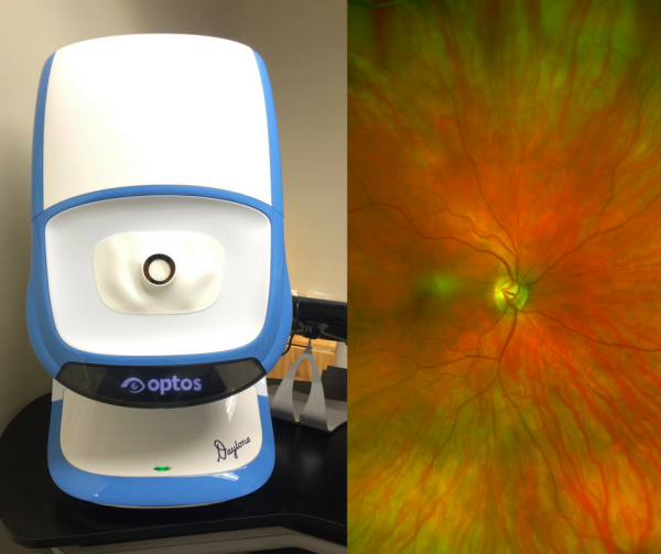 Retinal Imaging: A Revolution in Disease Detection & Prevention